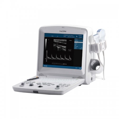 Digitální ultrazvukový diagnostický zobrazovací systém DUS 60